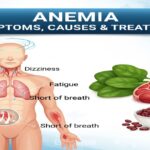 Anemia Symptoms, Causes, Treatment and Diet Guide in Roman Urdu. Visual representation of anemia symptoms, iron-rich foods, and medical graphics for better understanding.