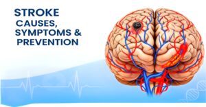 Stroke Causes, Silent Symptoms, Prevention Tips, and Home Treatment Guide