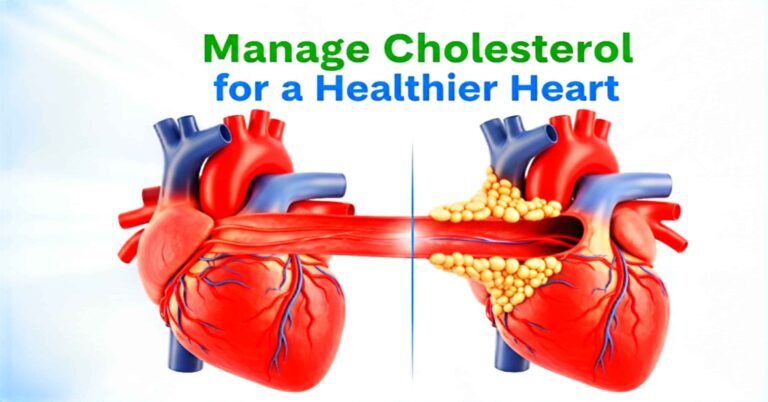 Image showing healthy heart and arteries with high cholesterol plaque buildup. Title: 'Manage Cholesterol for a Healthier Heart'.