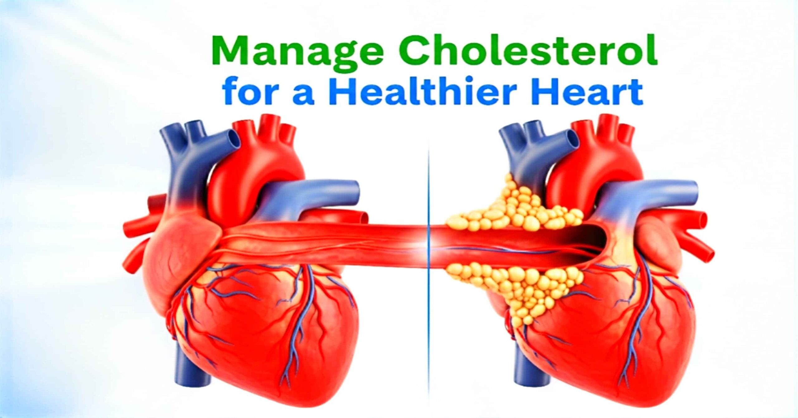 Image showing healthy heart and arteries with high cholesterol plaque buildup. Title: 'Manage Cholesterol for a Healthier Heart'.