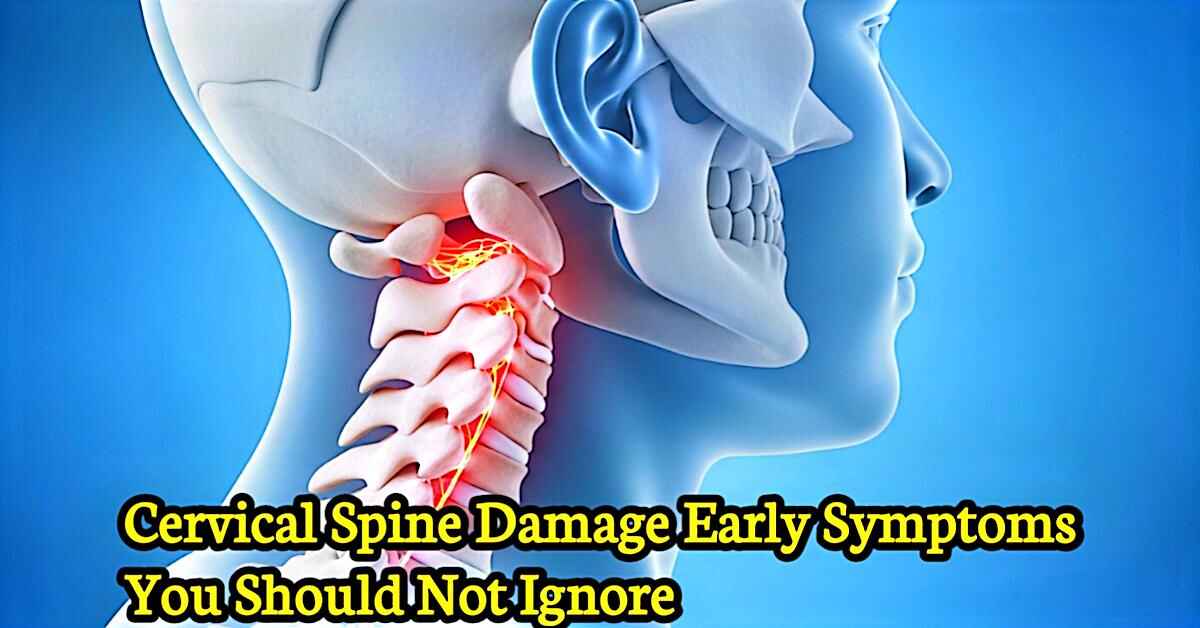 Cervical spine damage early symptoms shown in detailed medical neck anatomy illustration